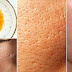 How To Remove Large Pores Within 24 Hours!