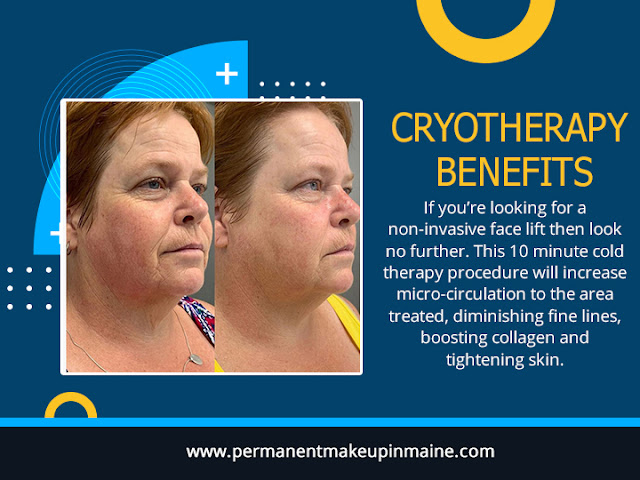 Cryotherapy Benefits
