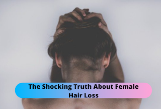 The Shocking Truth About Female Hair Loss