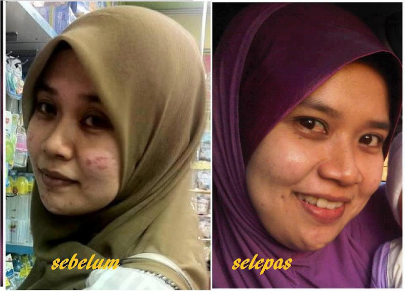 [GAMBAR][PROMOSI]TESTIMONI VITAMIN C 500MG (SARANAN PAKAR 