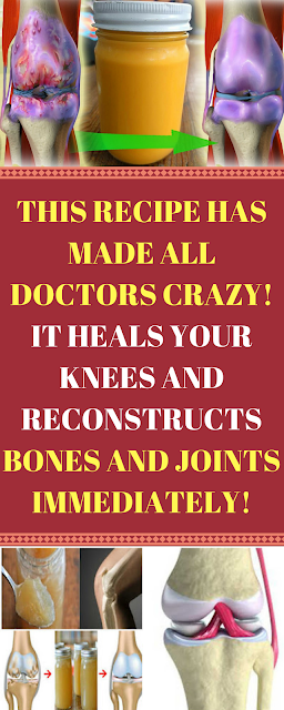 With This Recipe You Will Be Able to Strengthen and Restore Your Bones, Knees and Joints! Doctors are shocked by the Positive Results!