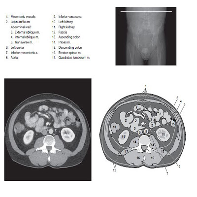 pelvic ct