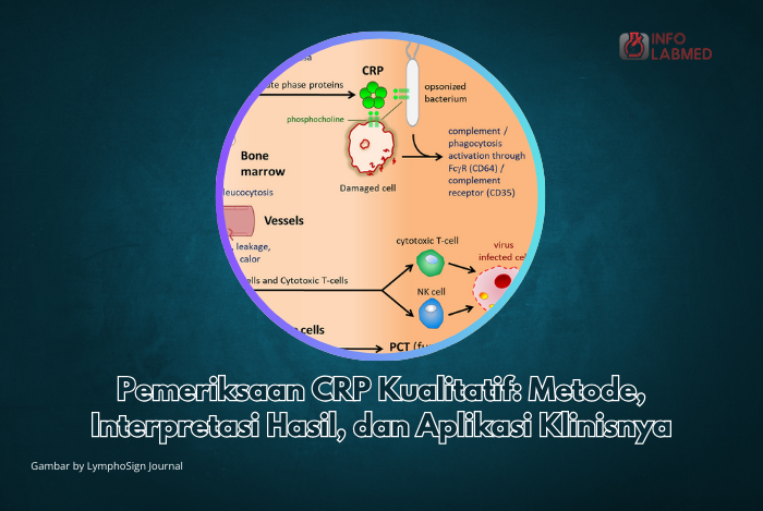 Pemeriksaan CRP Kualitatif: Metode, Interpretasi Hasil, dan Aplikasi Klinisnya