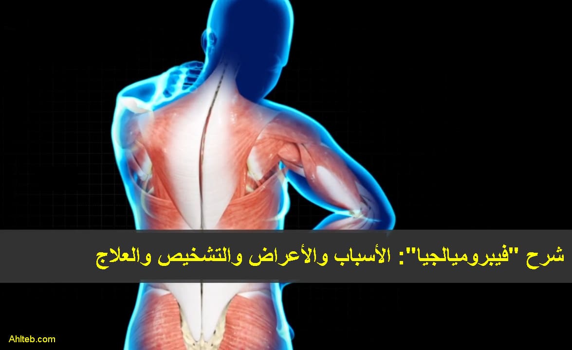 شرح الفيبروميالجيا (الألم العضلي-التليفي) بالتفصيل