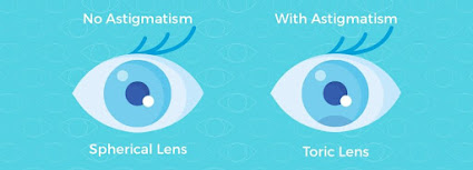 Toric Contact Lenses Work For Eyes