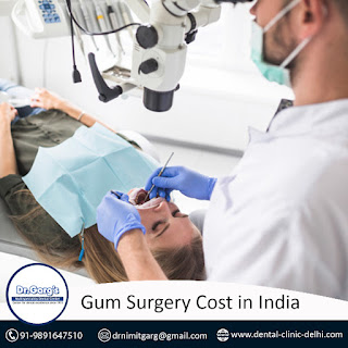 Gum Surgery Cost in India