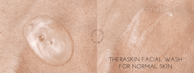 review-theraskin-for-normal-dry-skin