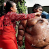 Emergency! World's Fattest Boy Who's Only 10 Years Old Placed On Crash Diet. (See Photos)