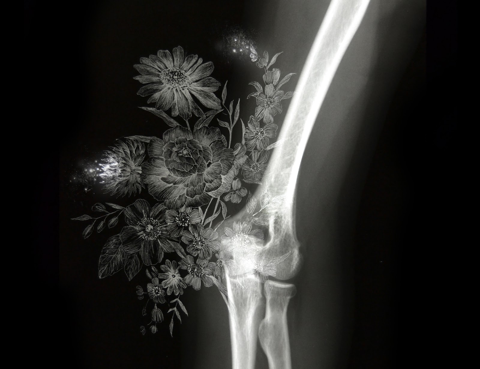 Nunzio Paci - Arthrosis, manually altered x-ray on LED lightbox