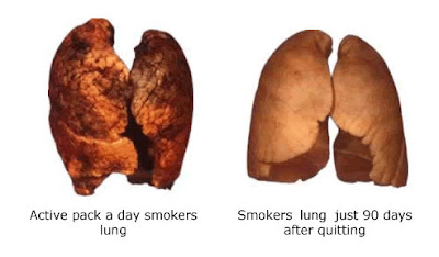 effect of smoking 