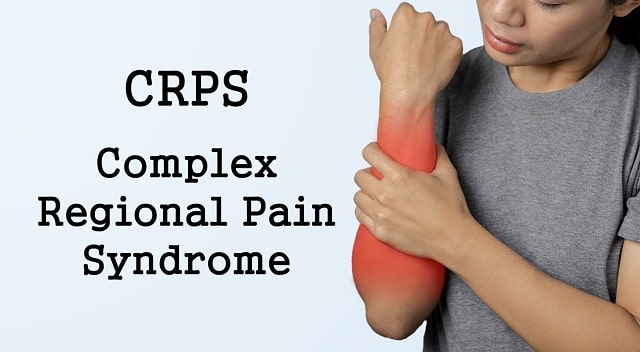 chronic discomfort treatment complex regional pain syndrome crps