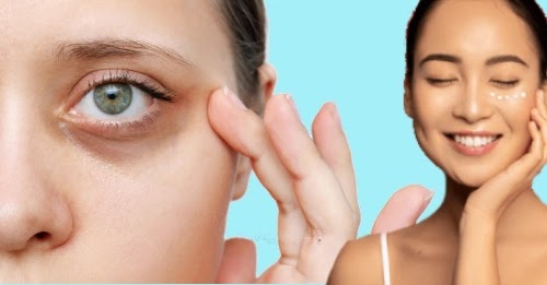 Fastest Way to Remove Dark Circles Naturally at Home in 2 Days