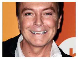 David Cassidy Plastic Surgery