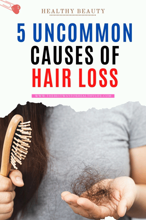 picture 5 uncommon causes of hair loss