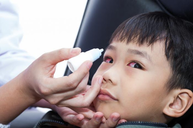 Cara Mengobati Sakit Mata pada Anak
