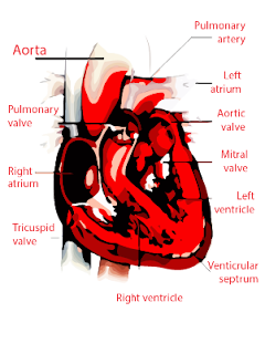 Pulmonary valve stenosis