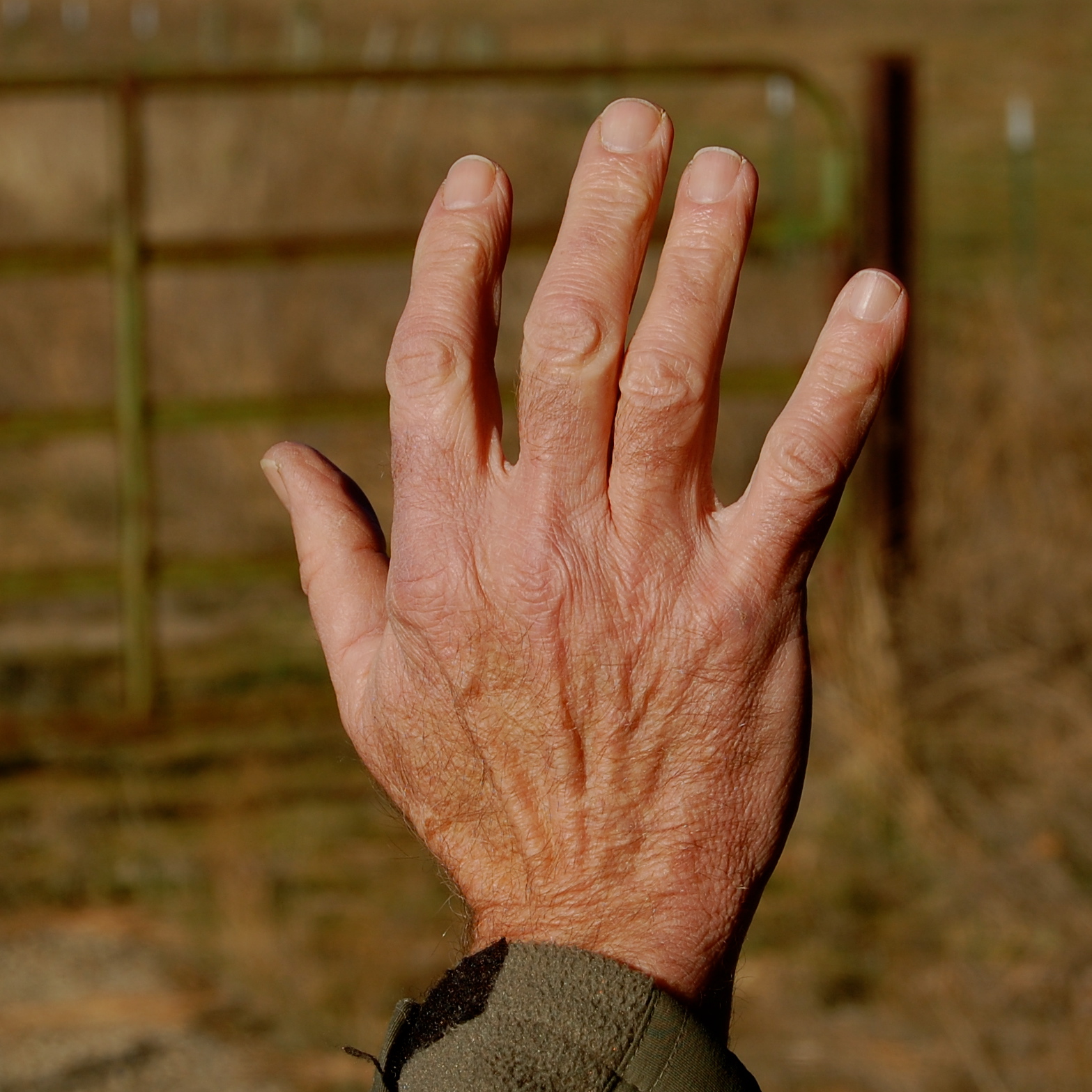 blackoaknaturalist: The Back of My Hand