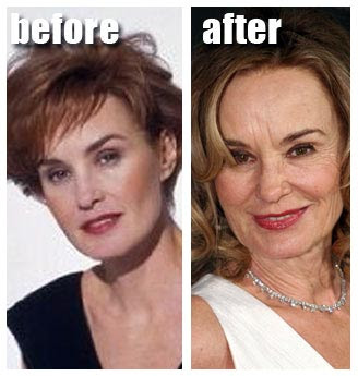Jessica Lange Plastic Surgery Before And After