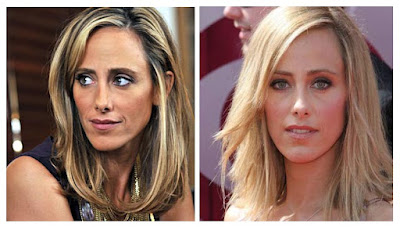 Kim Raver Nose Job