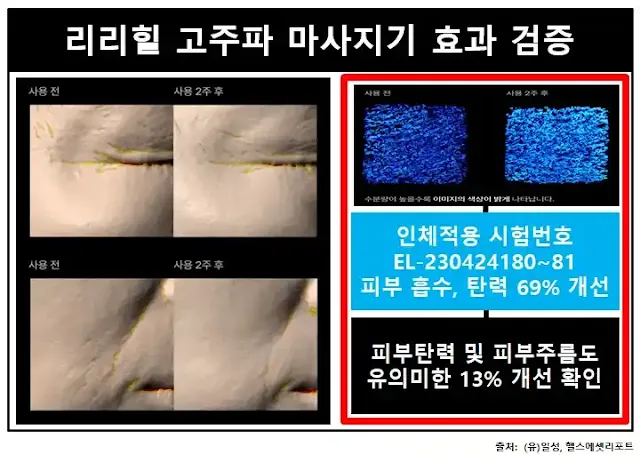 리리힐고주파마사지-효과