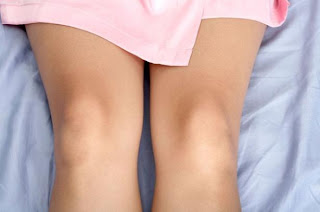 tips untuk memutihkan siku dan lutut yang hitam
