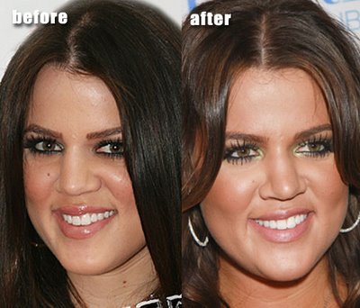 khloe kardashian fat. images Khloe Kardashian took