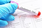 Cholesterol Test- Things You Have to Know About