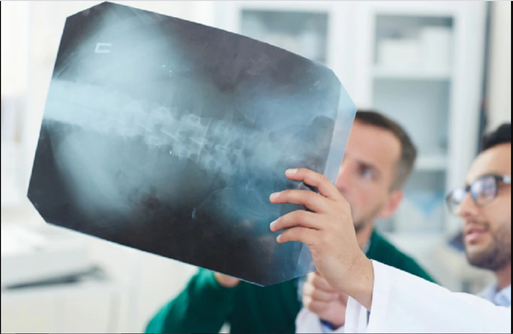 These 7 signs show that your bones are getting weak, carelessness may cause many problems in later life