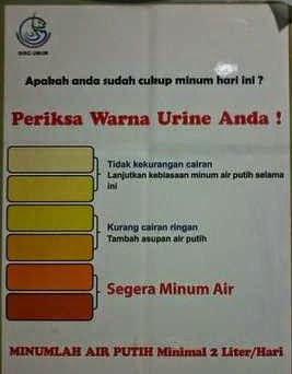 warna urine