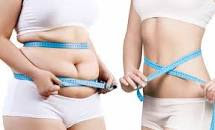 Bariatric Surgery in Dubai for Weight loss