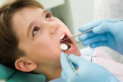  Khi nào trẻ thay răng sữa?