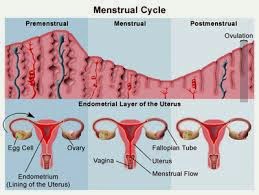  MENORRHAGIA, MENSTRUASI YANG BERLEBIHAN, BAGAIMANA CARA MENGETAHUINYA?