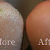 Home Remedies for Cracked Heels
