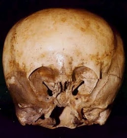 900 Years Old 'Starchild' Skull: Alien-like Skull found in Mexico