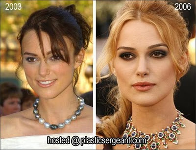Jennifer Aniston Nose Job Before And After. megan fox nose job before and