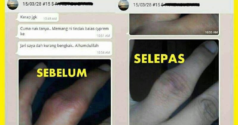 Ubat Untuk Gout - Dev Gaol