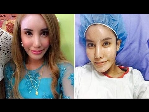 10 Gambar Transgender Sebelum Vs Selepas 