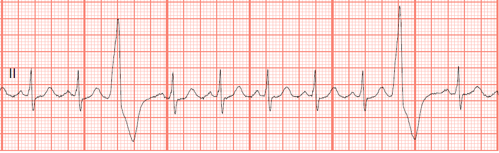 Float Nurse Ekg Quiz 327