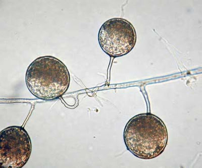 Glomeromycota: Pengertian, Ciri, Struktur, Reproduksi, Contoh dan Manfaat