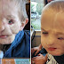 Boy, 5, survives savage attack by two dogs only to be called a ‘monster’ in public