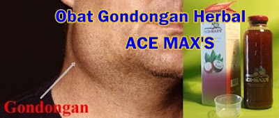 Obat Gondongan Alami, Ampuh Menyembuhkan Gondongan Secara Alami