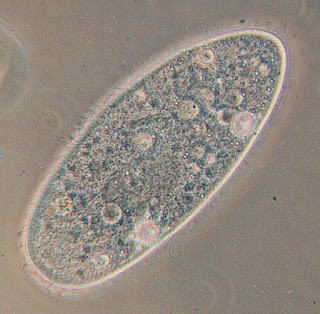 A Paramecium aurelia seen through an optical microscope