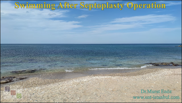 When can you the dive be done after the septoplasty operation?,When to dive into after the septoplasty?,Swimming after septoplasty operation,When can you enter the sea after a septoplasty operation?,