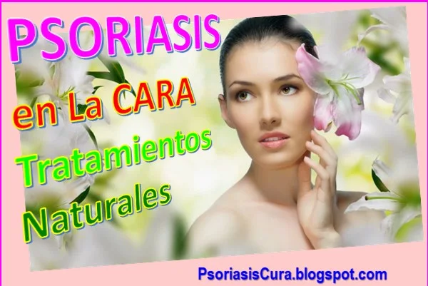 psoriasis-en-la-cara-tratamiento-facial-natural-remedios-caseros