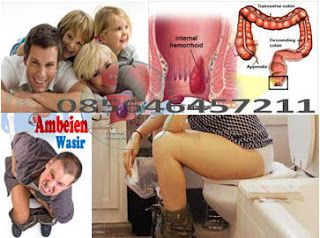 Obat Antihemoroid Oral Tradisional Ambejoss