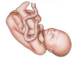 Resultado de imagem para estatica fetal