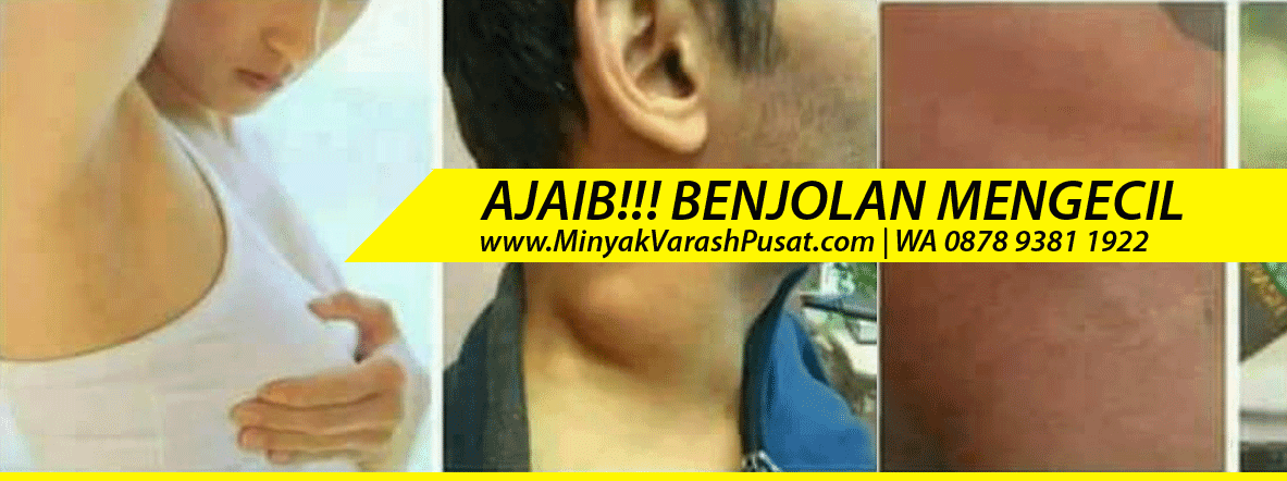 TIDAK SESAK LAGI, Minyak Varash untuk Benjolan di Payudara