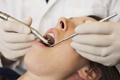 Vôi răng gây hôi miệng - Chỉ bạn cách xử lý 2