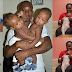 Nigerian conjoined Twins finally gets separated after successful surgery involving 22 doctors