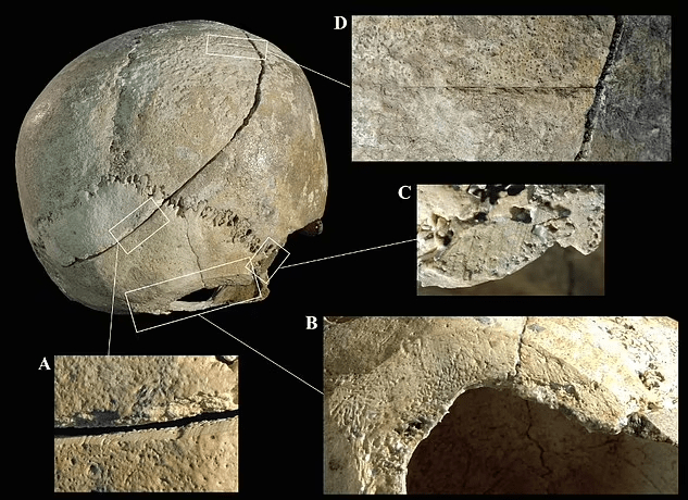 Η ανάλυση αποκάλυψε ότι και τα τέσσερα χτυπήματα πιθανόν προκλήθηκαν με το ίδιο όπλο, πιθανότατα κάποιο αιχμηρό σπαθί. Οι τραυματισμοί από κάθε ένα από τα τέσσερα χτυπήματα αναφέρονται ως D,C,B και A και προκλήθηκαν με αυτή τη σειρά. [Credit: Tesi C]